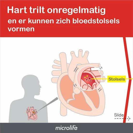 Microlife BP B3 AFIB - Bovenarm Bloeddrukmeter - Klinisch Gevalideerd - No. 1 Merk Bij Huisartsen 6 Microlife BP B3 AFIB - Bovenarm Bloeddrukmeter - Klinisch Gevalideerd - No. 1 Merk Bij Huisartsen - Afbeelding 4